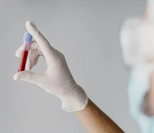 Koliko je inficiranih u Srbiji od kada je otkriven HIV? koliko-je-inficiranih-u-srbiji-od-kada-je-otkriven-hiv?