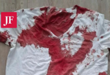 Napad Antife na političare u Rostoku: Levičarski ekstremisti pretukli poslanika ispred kuće napad-antife-na-politicare-u-rostoku:-levicarski-ekstremisti-pretukli-poslanika-ispred-kuce